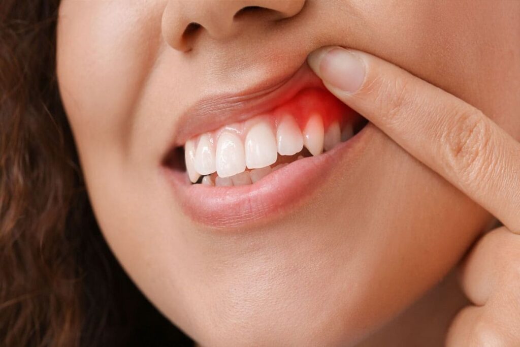 how gum disease can harm your overall health
